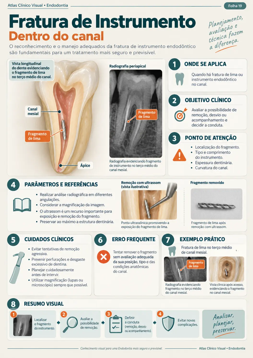 Exemplo de mapa clínico visual de endodontia