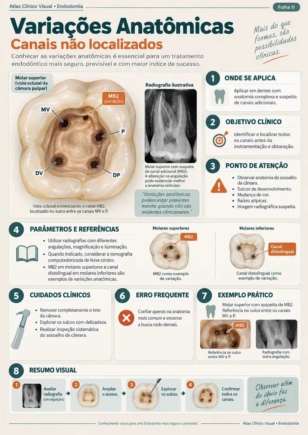 Exemplo de mapa clínico visual de endodontia
