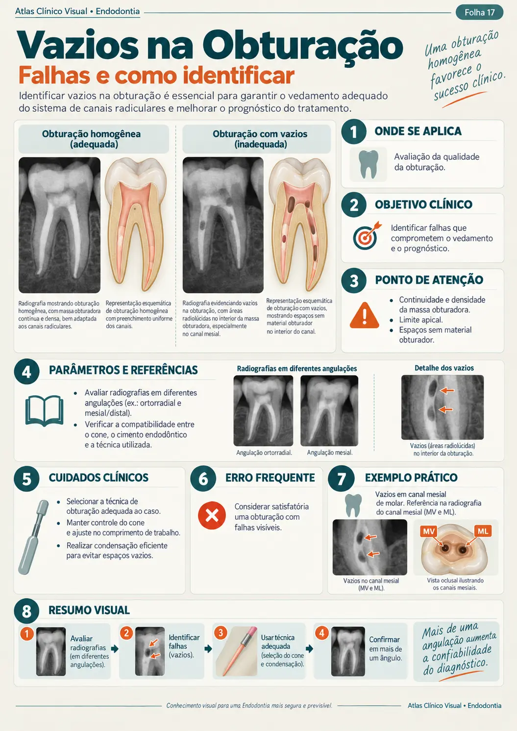 Exemplo de mapa clínico visual de endodontia