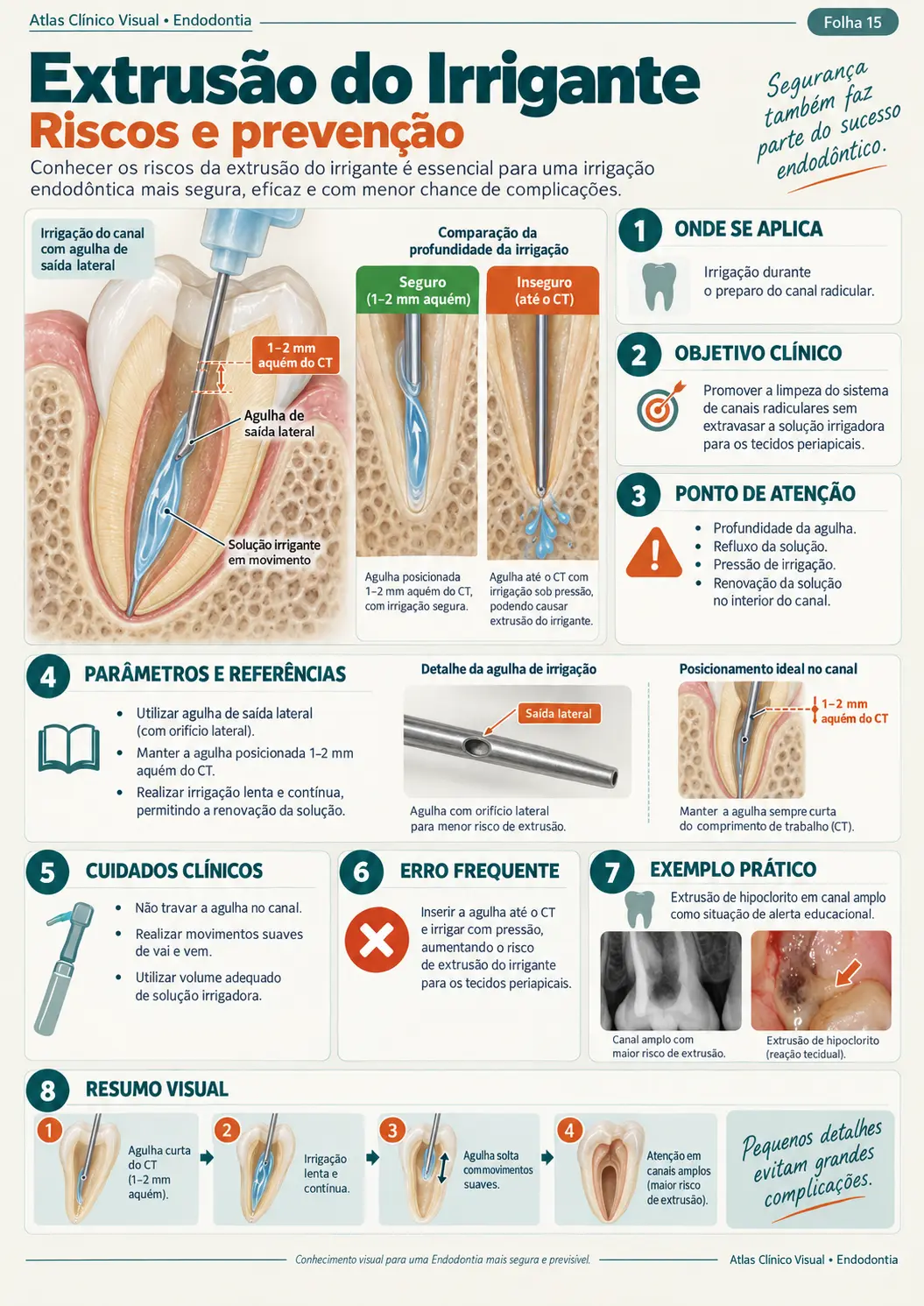 Exemplo de mapa clínico visual de endodontia