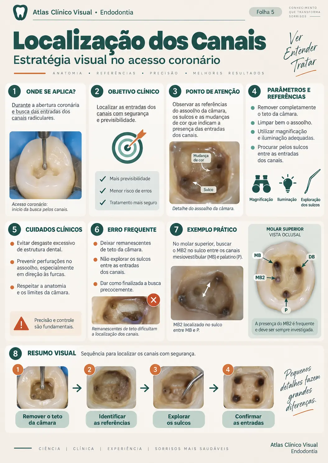 Exemplo de mapa clínico visual de endodontia