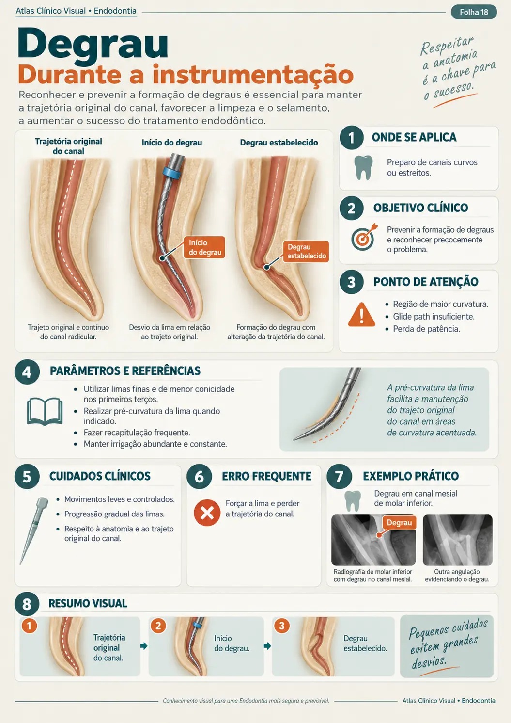 Exemplo de mapa clínico visual de endodontia